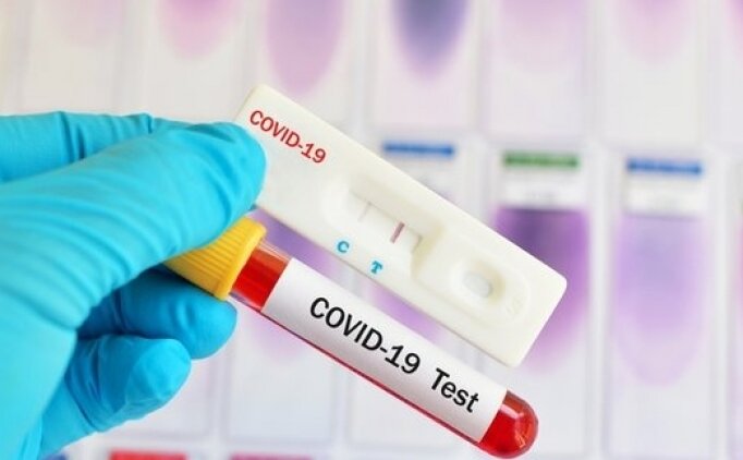 Hızlı PCR Test