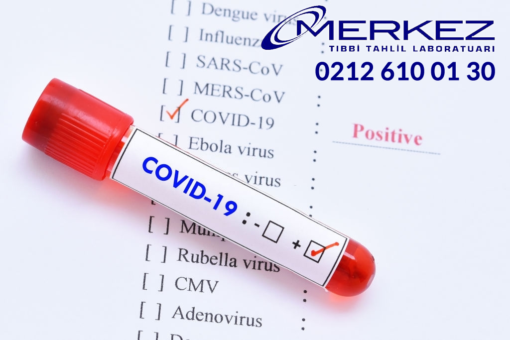 Korona virüs (covid-19) testleri, PCR testi